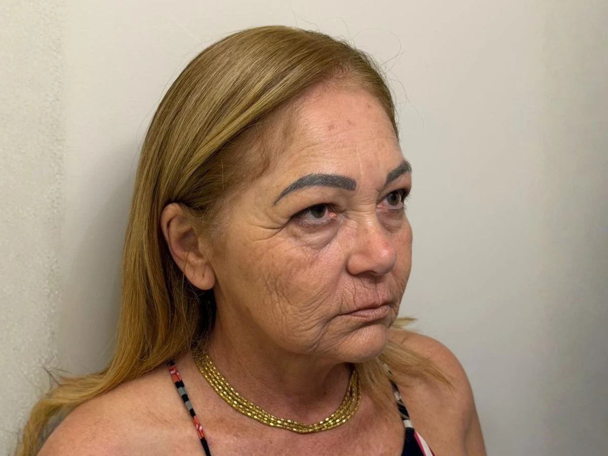 Antes Protocolo Elleve